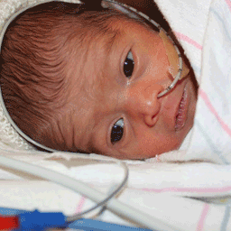 pediatric img